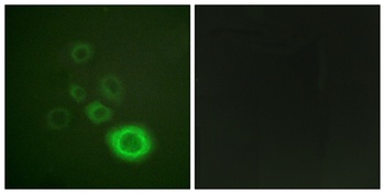 Met (phospho Tyr1003) rabbit pAb Antibody