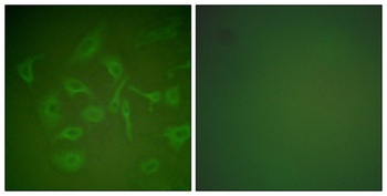 Mammaglobin A rabbit pAb Antibody
