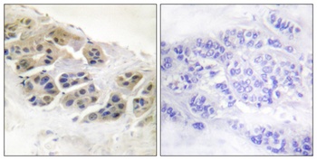 Mammaglobin A rabbit pAb Antibody