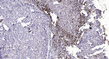 MGST2 rabbit pAb Antibody