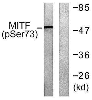 MITF (phospho Ser180) rabbit pAb