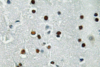 ASCL1 rabbit pAb