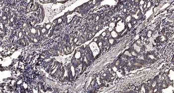 MLF1 rabbit pAb Antibody