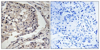MLK1/2 rabbit pAb