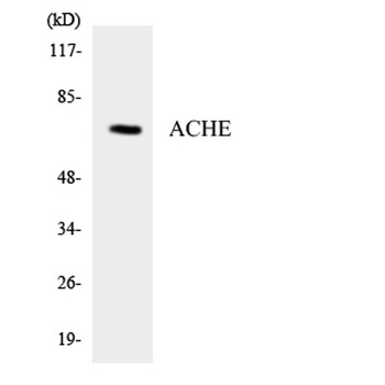 AChE antibody