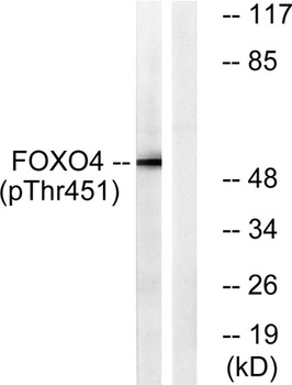 FoxO4 (phospho Thr451) rabbit pAb Antibody