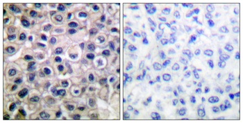 MMP-14 rabbit pAb
