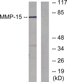 MMP-15 antibody