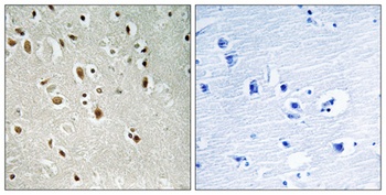 ANKRD20 antibody