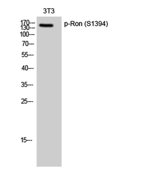 Ron (phospho-Ser1394) antibody