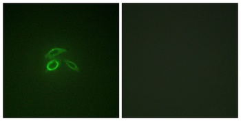 Mucin 1 (phospho Tyr1229) rabbit pAb