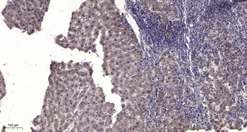MuSK (phospho-Tyr755) antibody