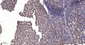 MuSK (phospho Tyr755) rabbit pAb