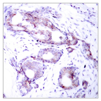 c-Myc (phospho-Ser373) antibody