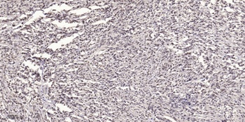 MYLK (phospho-Tyr464) antibody