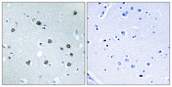 Myosin Id rabbit pAb