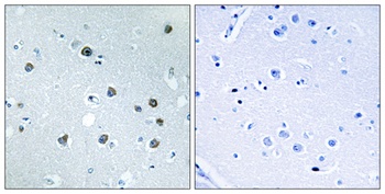 Myosin Id antibody