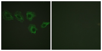 MYPT1 (phospho-Thr696) antibody
