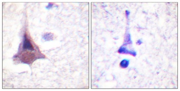 MYPT1 rabbit pAb