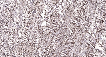 NACA (phospho-Ser43) antibody