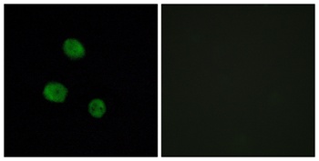 hnRNP M antibody