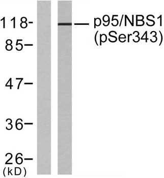 Nibrin (phospho-Ser343) antibody