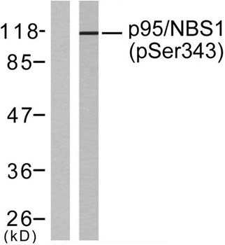 Nibrin (phospho Ser343) rabbit pAb