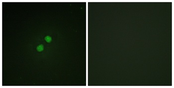 Nibrin (phospho Ser278) rabbit pAb Antibody