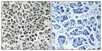 NDUFA3 antibody