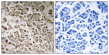 NDUFB1 antibody