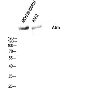 Atm antibody