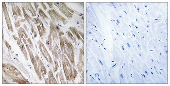 NDUFS5 antibody