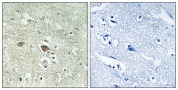 NDUFV3 rabbit pAb