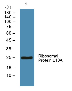 Ribosomal Protein L10A rabbit pAb