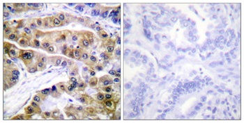 Na+/K+-ATPase alpha1 (phospho-Ser16) antibody