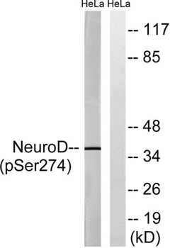 Neuro D (phospho Ser274) rabbit pAb