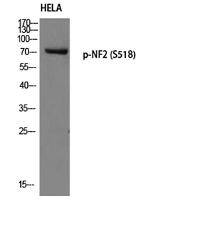 NF2 (phospho-Ser518) antibody