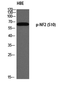 NF2 (phospho Ser10) rabbit pAb