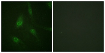 NFATc3 (phospho-Ser165) antibody