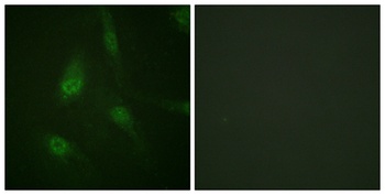 NFATc3 (phospho Ser165) rabbit pAb