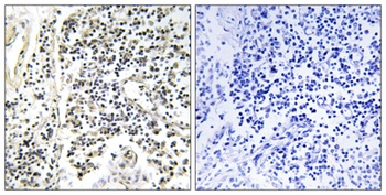 IκB-α (phospho Tyr305) rabbit pAb
