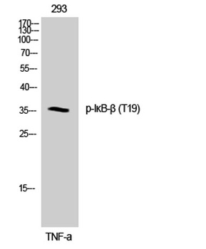 IκB-β (phospho Thr19) rabbit pAb