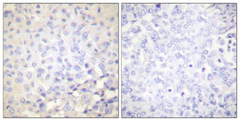 IκB-ε (phospho Ser22) rabbit pAb