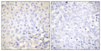 I kappa B-Epsilon (phospho-Ser22) antibody