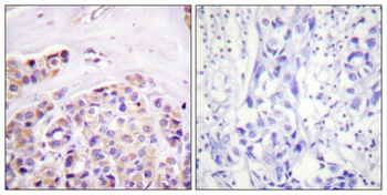 IκB-ε rabbit pAb