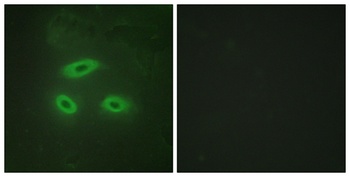 NK-TR antibody