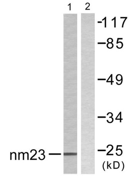 NM23-H2 antibody