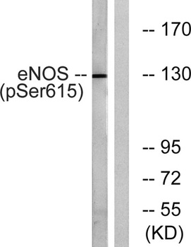 eNOS (phospho Ser615) rabbit pAb Antibody