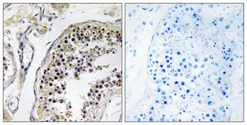 CNOT4 antibody