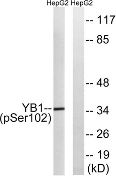 YB-1 (phospho-Ser102) antibody